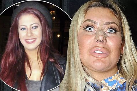 chloe ferry website|chloe ferry before and after.